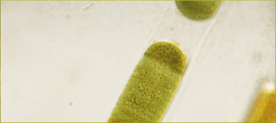 cyano bacteria